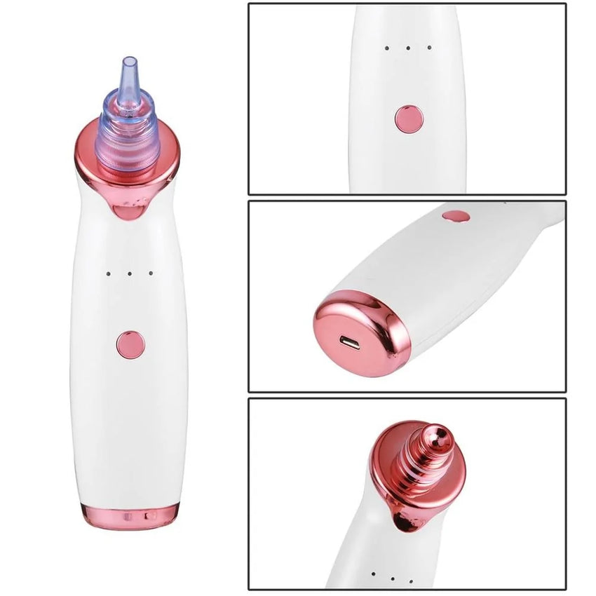 Clearskin Pro Blackhead Suction Device